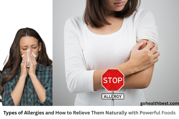 Types of Allergies