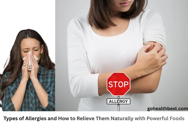 Types of Allergies